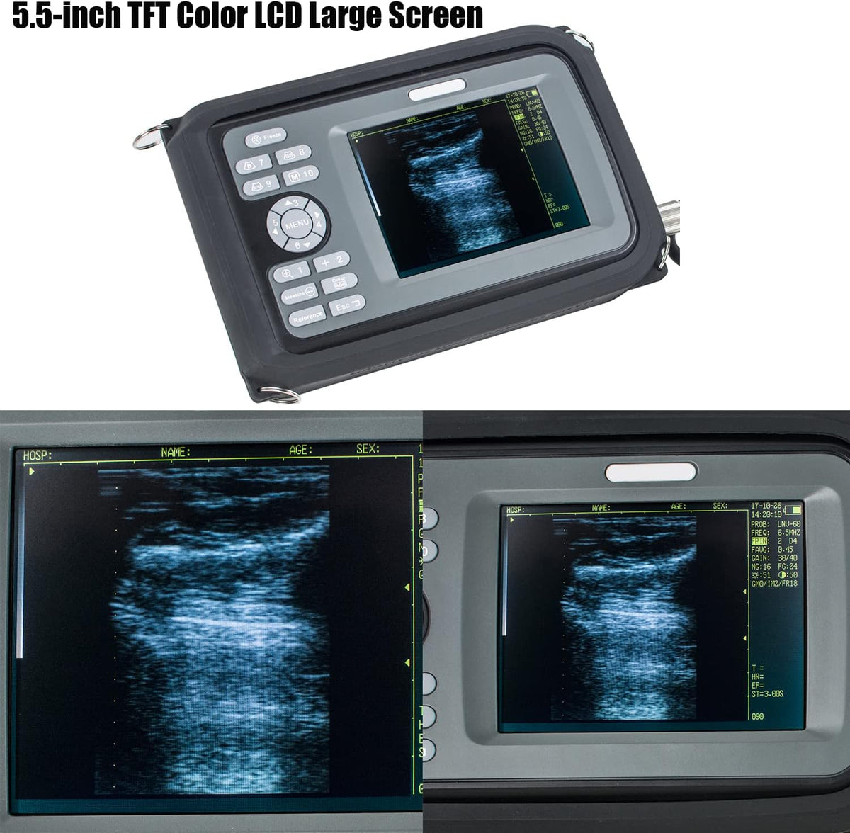 Veterinary Portable Ultrasound Scanner with 4.0MHz Rectal Convex Probe O947